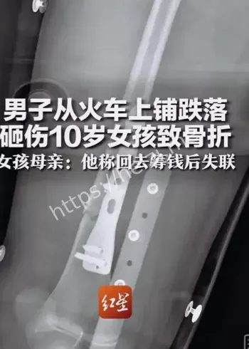 列车上铺跌落砸伤事件